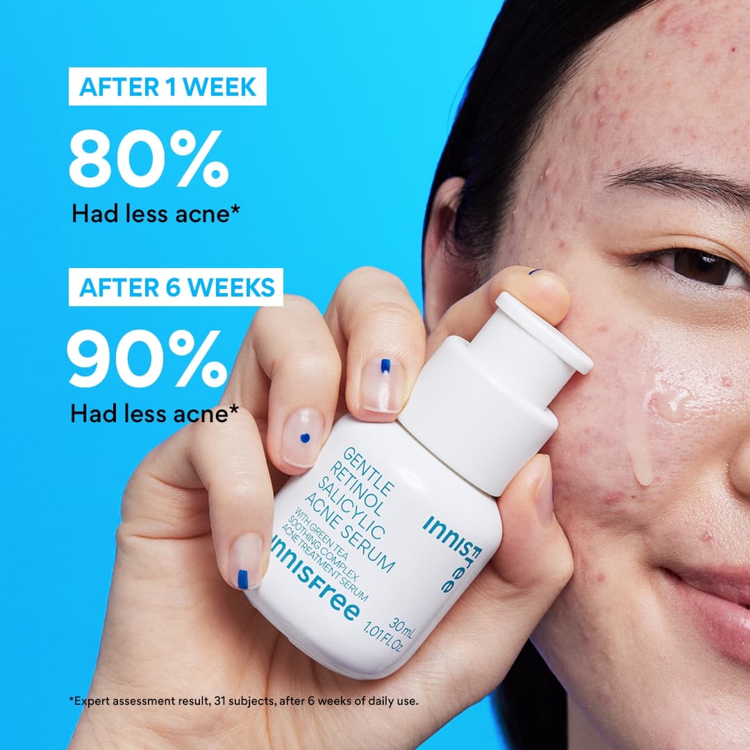 Gentle Retinol Salicylic Acne Serum - Image 3