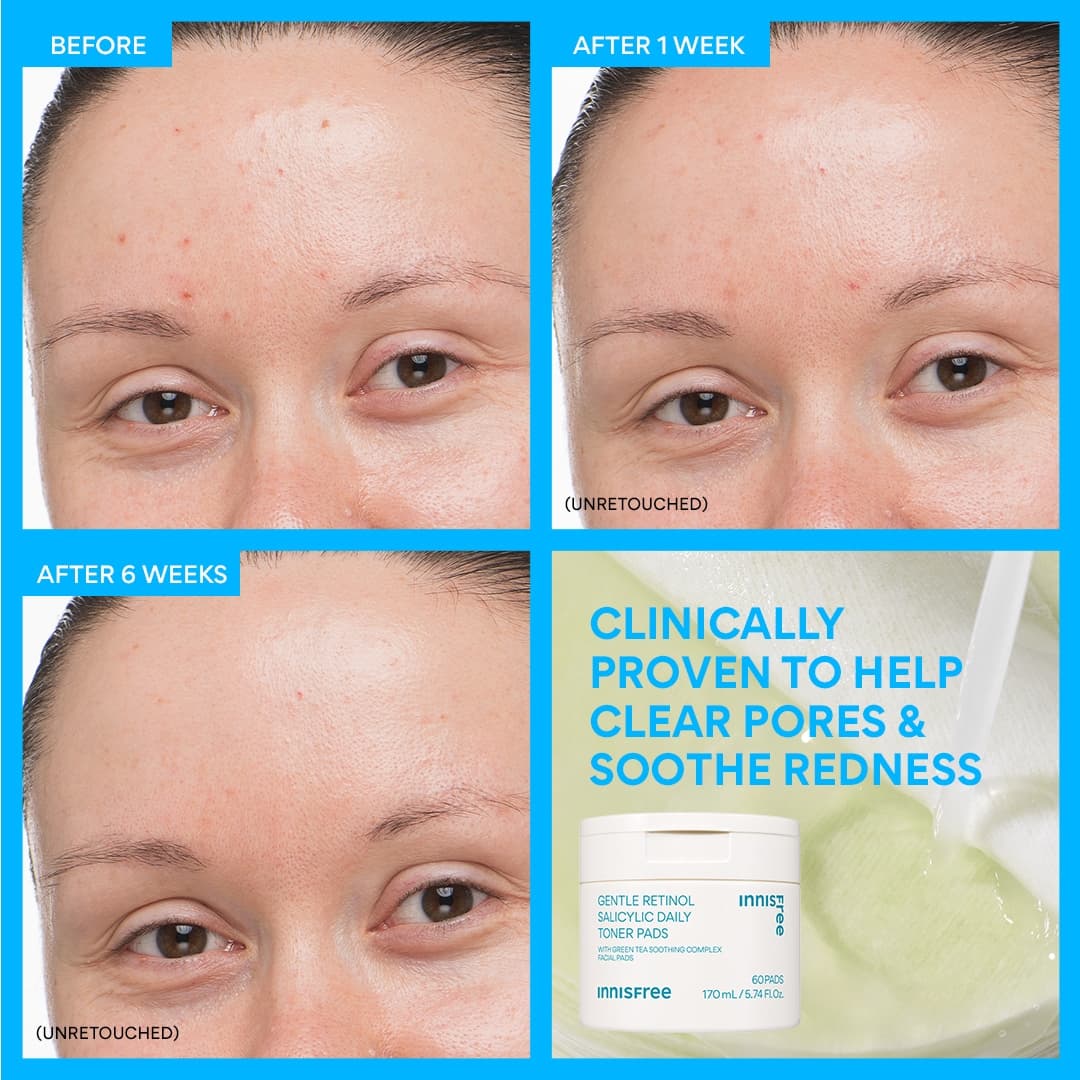 Daily Gentle Retinol Salicylic Toner Pads - Image 4