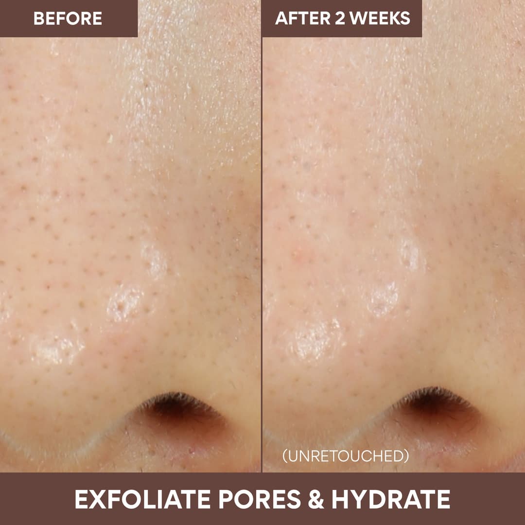 Volcanic Swirl Pore Mask - Image 4