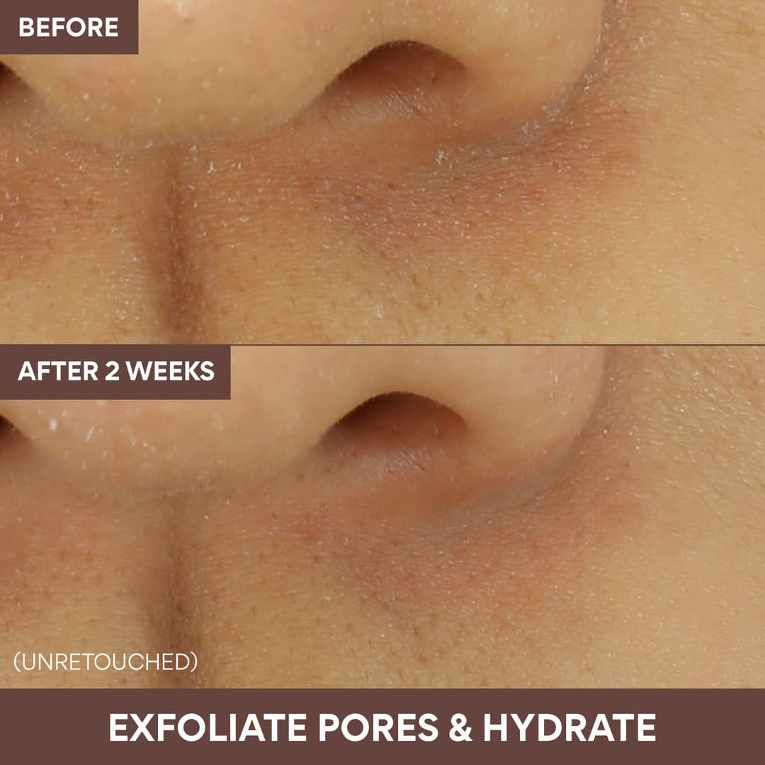 Volcanic Swirl Pore Mask - Image 5