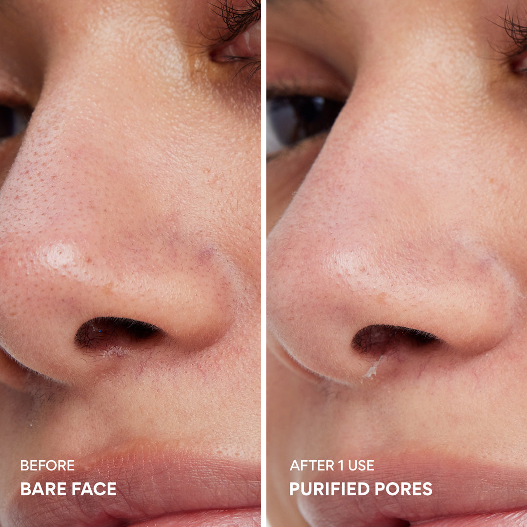 Super Volcanic Pore Clay Mask – Deep Cleanse & Clear Face Pores - Image 4
