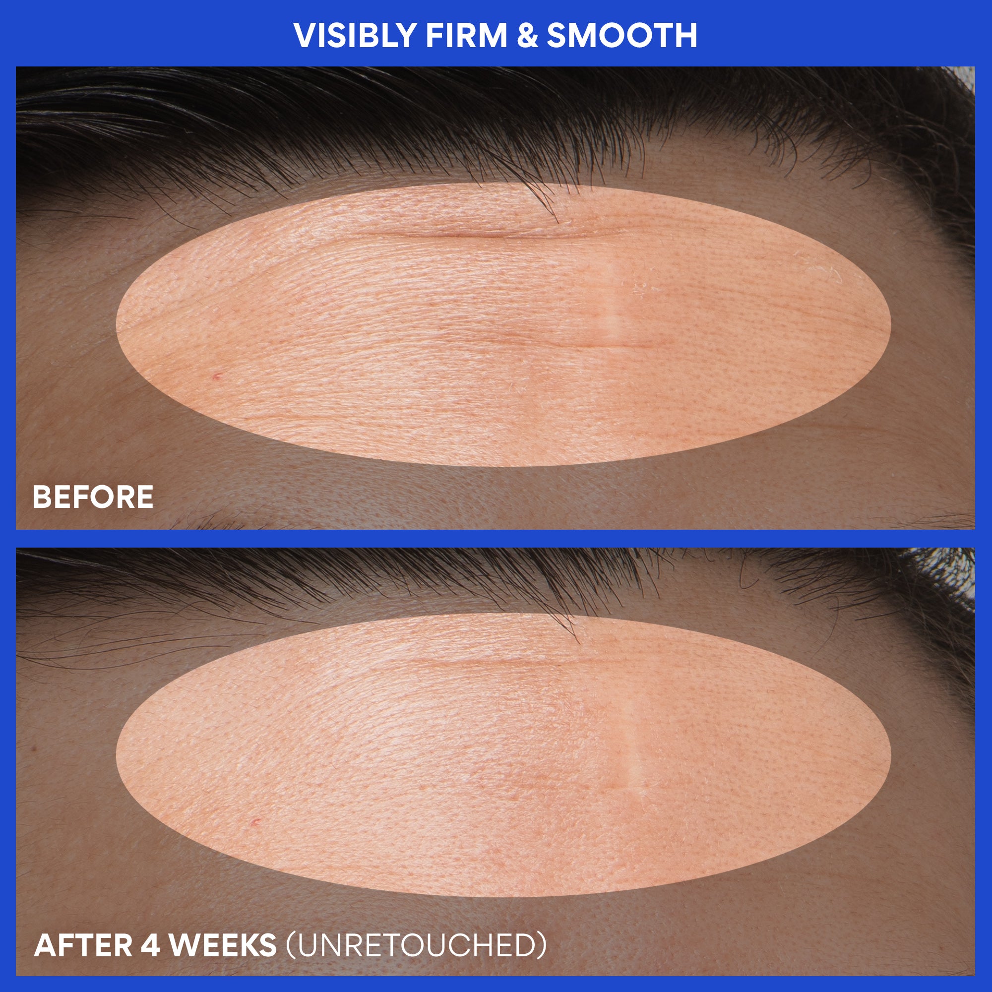 Retinol Green Tea PDRN™ Firming Serum - Image 7