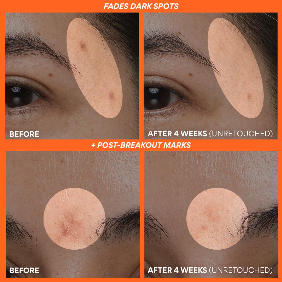 The Dewy Skin Kit - Image 7