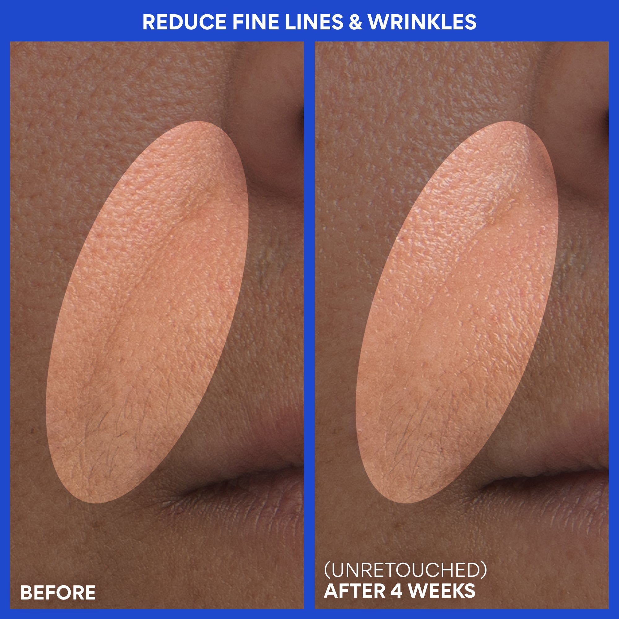 Retinol Green Tea PDRN™ Firming Serum - Image 10