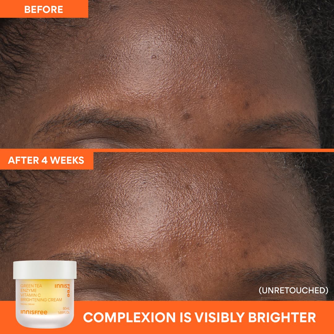 The Dewy Skin Kit - Image 9