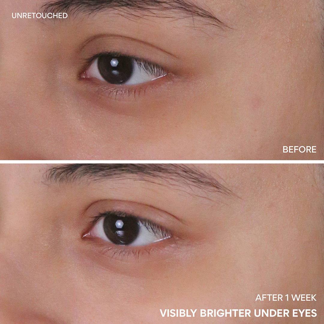 Vitamin C Niacinamide Brightening Eye Serum - Image 5